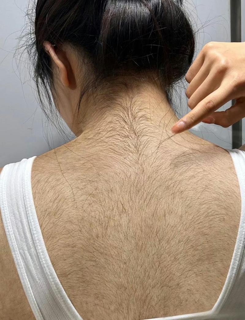 什么是体毛、什么体毛是美女